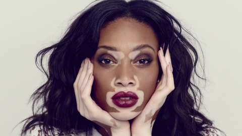 Vloggers making a difference: Winnie Harlow