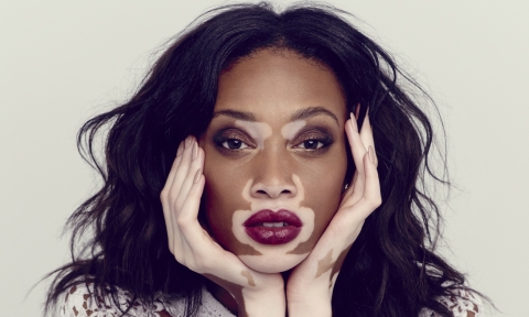 Vloggers making a difference: Winnie Harlow